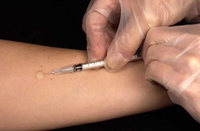 Ante epidemia de sarampión en EEUU, menores sin vacunas no podrán estar en espacios públicos