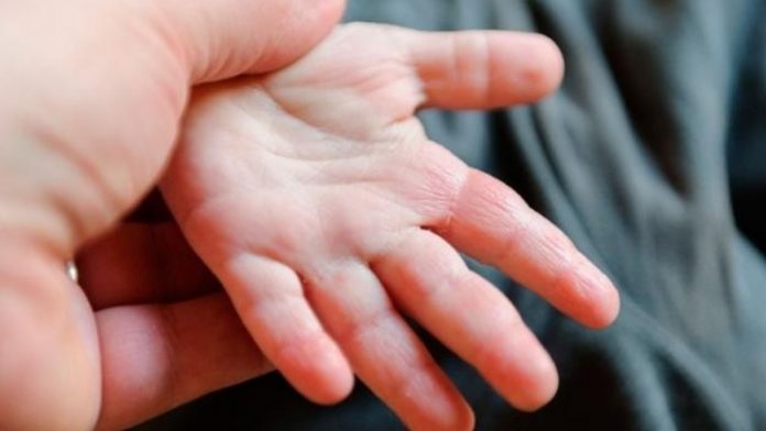La artritis también afecta a los niños y adolescentes