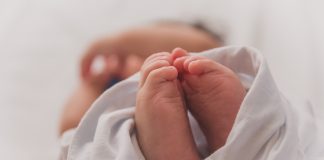 Conmoción en el mundo médico por bebé que nació sin rostro