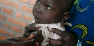 Epidemia de sarampión en el Congo ha matado a más de 6 mil personas en un año
