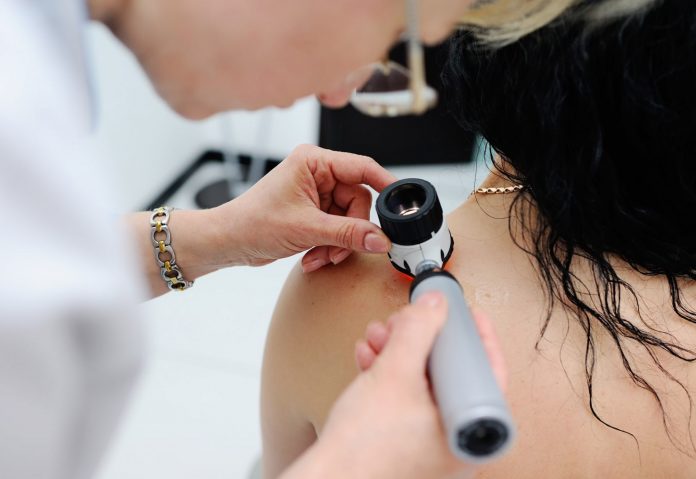 El cáncer de piel es el segundo más frecuente en México