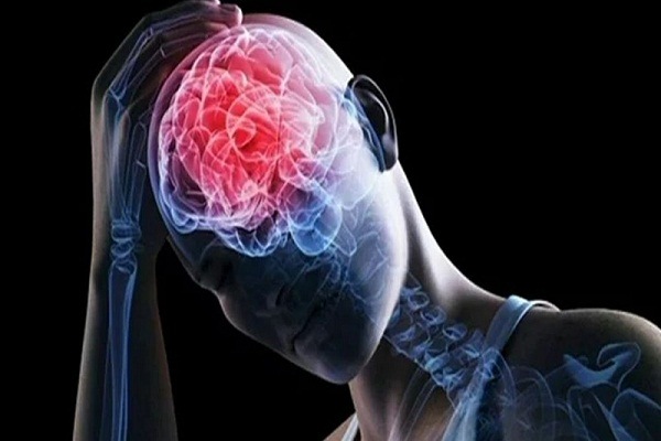 Científicos encuentran evidencia de daño cerebral en pacientes covid