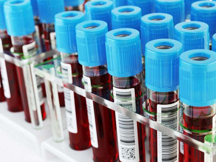 Diagnosticarán cáncer con pruebas de sangre