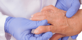 Tratamiento para artritis podría funcionar para Covid-19