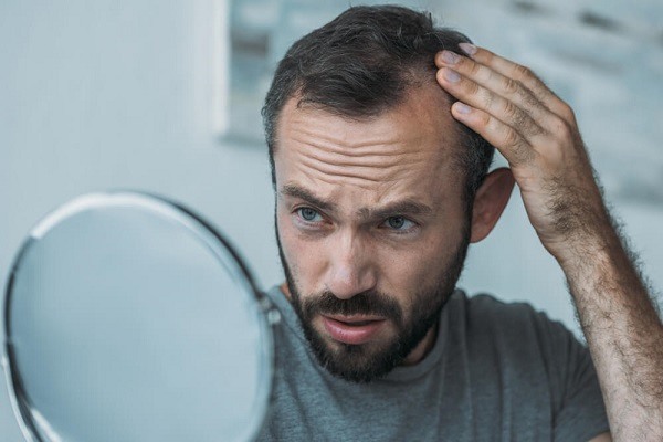 Estrés durante pandemia puede provocar caída de cabello