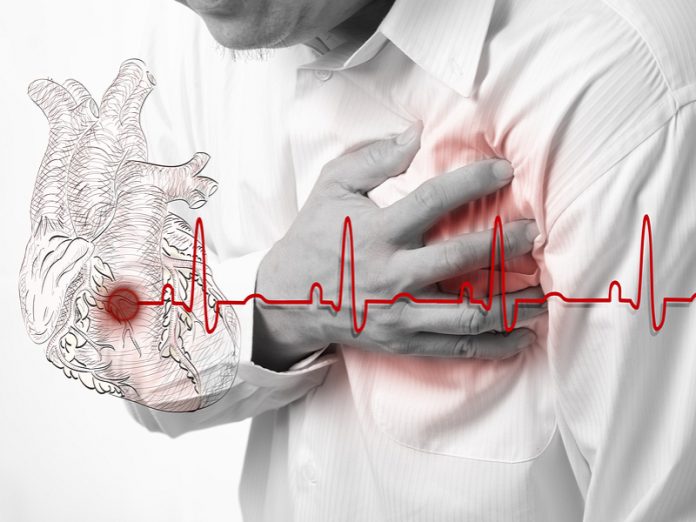 Dolencias cardiacas se mantienen como principal causa de muerte en el mundo