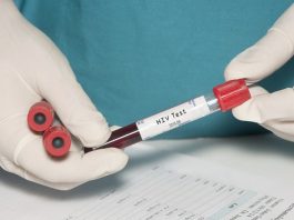 Yucatán inicia pruebas de vacuna experimental contra VIH