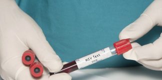 Yucatán inicia pruebas de vacuna experimental contra VIH