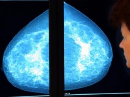 Hormonas masculinas podrían ser una clave para curar el cáncer de mama