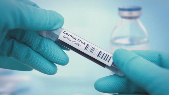Mutaciones de coronavirus pueden dar falsos negativos en las pruebas