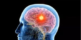 La curación de lesiones cerebrales se relaciona con un tipo de cáncer, advierte estudio
