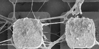Científicos usarán células madre del cerebro para crear microchips