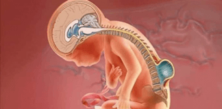 Logran primera cirugía fetal para corregir espina bífica en CDMX