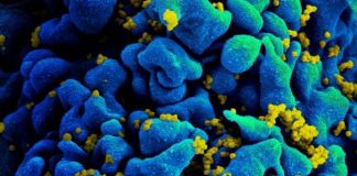 Encuentran que el virus del VIH ayuda a curar mal del "bebé burbuja"