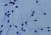 Científicos cuestionan si es real el descenso del recuento de esperma humano a nivel mundial