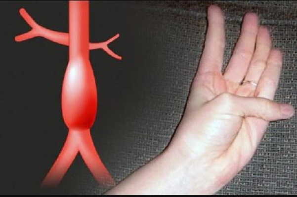 Con el movimiento de un dedo puedes saber si padeces una condición cardiovascular grave