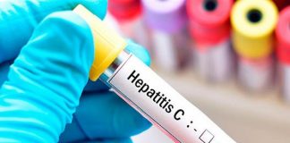Medio millón de mexicanos están infectados con hepatitis C