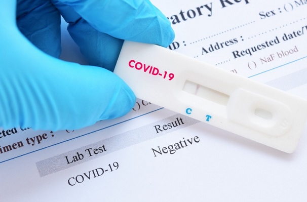 Crean prueba Covid-19 que detecta hasta variantes del virus
