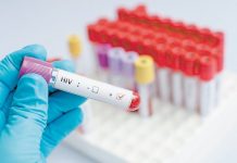 Tratamiento con proteínas sintéticas conduciría a la cura del VIH
