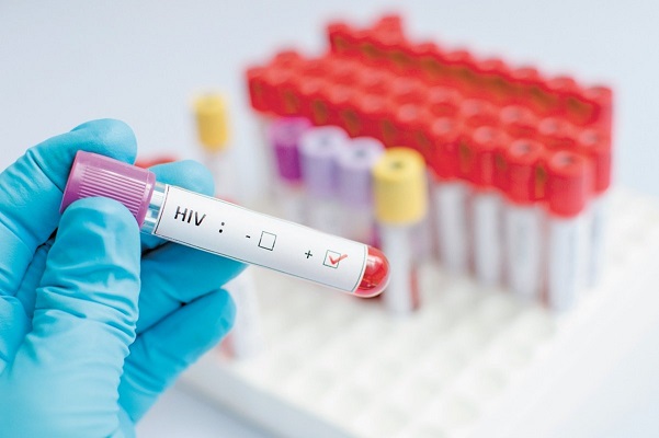 Tratamiento con proteínas sintéticas conduciría a la cura del VIH