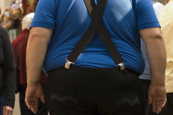 Los 4 tipos de obesidad y por qué es importante categorizarlos