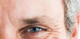 Arrugas en la cara son un riesgo de enfermedad cardiovascular, alerta estudio