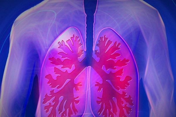 La tuberculosis es curable si se detecta a tiempo, asegura el IMSS